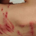 Jongen van 6 jaar heeft bijtwonden na mogelijk incident met wolf