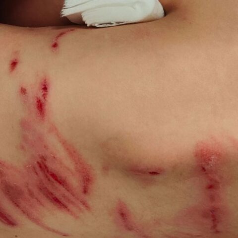 Jongen van 6 jaar heeft bijtwonden na mogelijk incident met wolf
