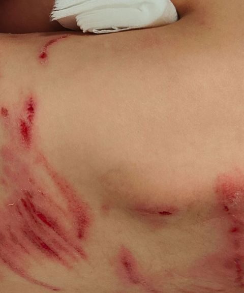 Jongen van 6 jaar heeft bijtwonden na mogelijk incident met wolf
