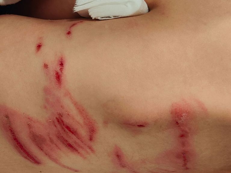 Jongen van 6 jaar heeft bijtwonden na mogelijk incident met wolf
