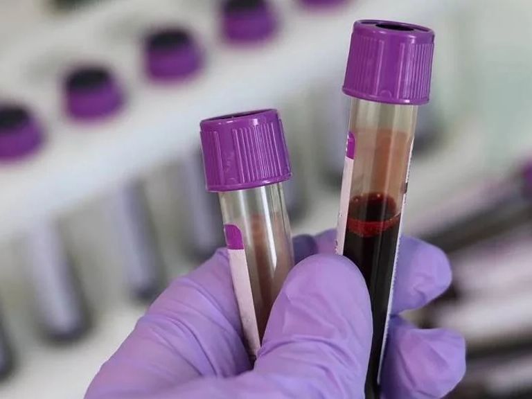 Anesthesist in Veldhoven stopt na gebruik van navelstrengbloed bij 200 kinderen