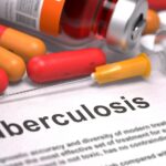 Minimaal 11 mensen met tuberculose gediagnosticeerd in Arnhem