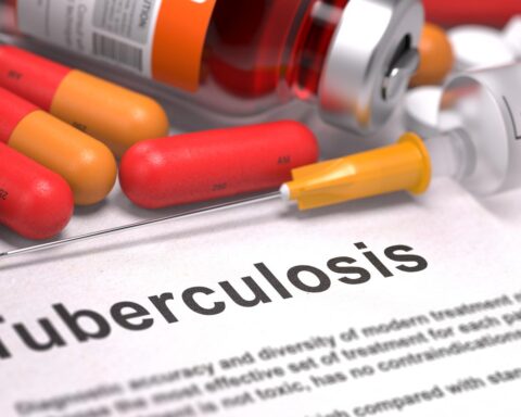 Minimaal 11 mensen met tuberculose gediagnosticeerd in Arnhem