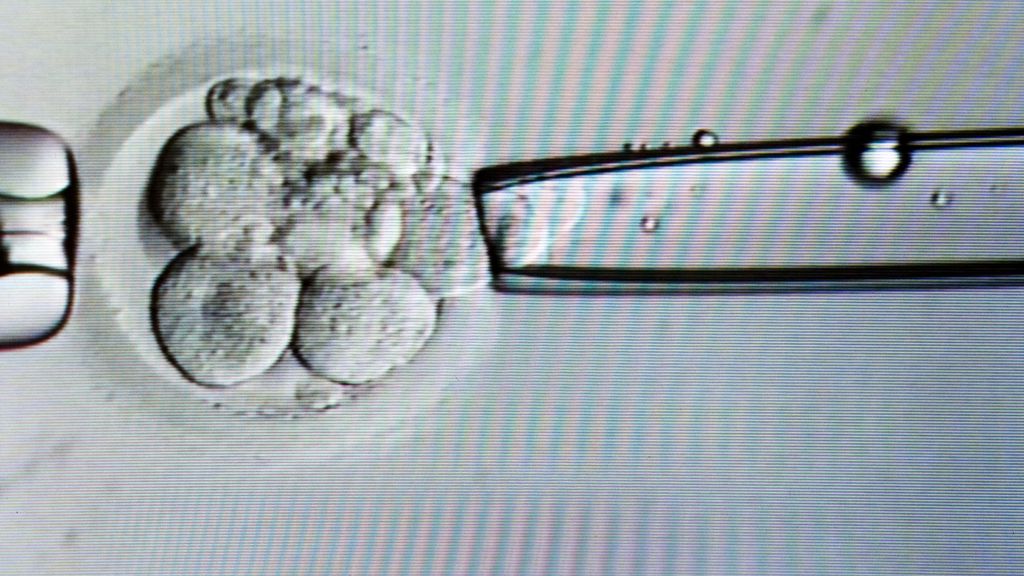 Ruimere embryowet leidt tot verdeeldheid in de Tweede Kamer