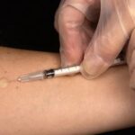 Uitbraak van tuberculose onder dak- en thuislozen in Arnhem vastgesteld