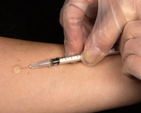 Uitbraak van tuberculose onder dak- en thuislozen in Arnhem vastgesteld