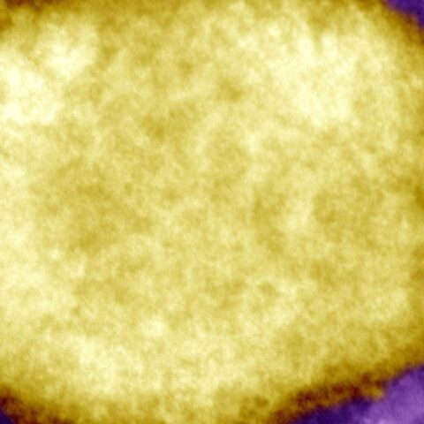 Nederland meldt eerste geval van nieuwe monkeypox-stam