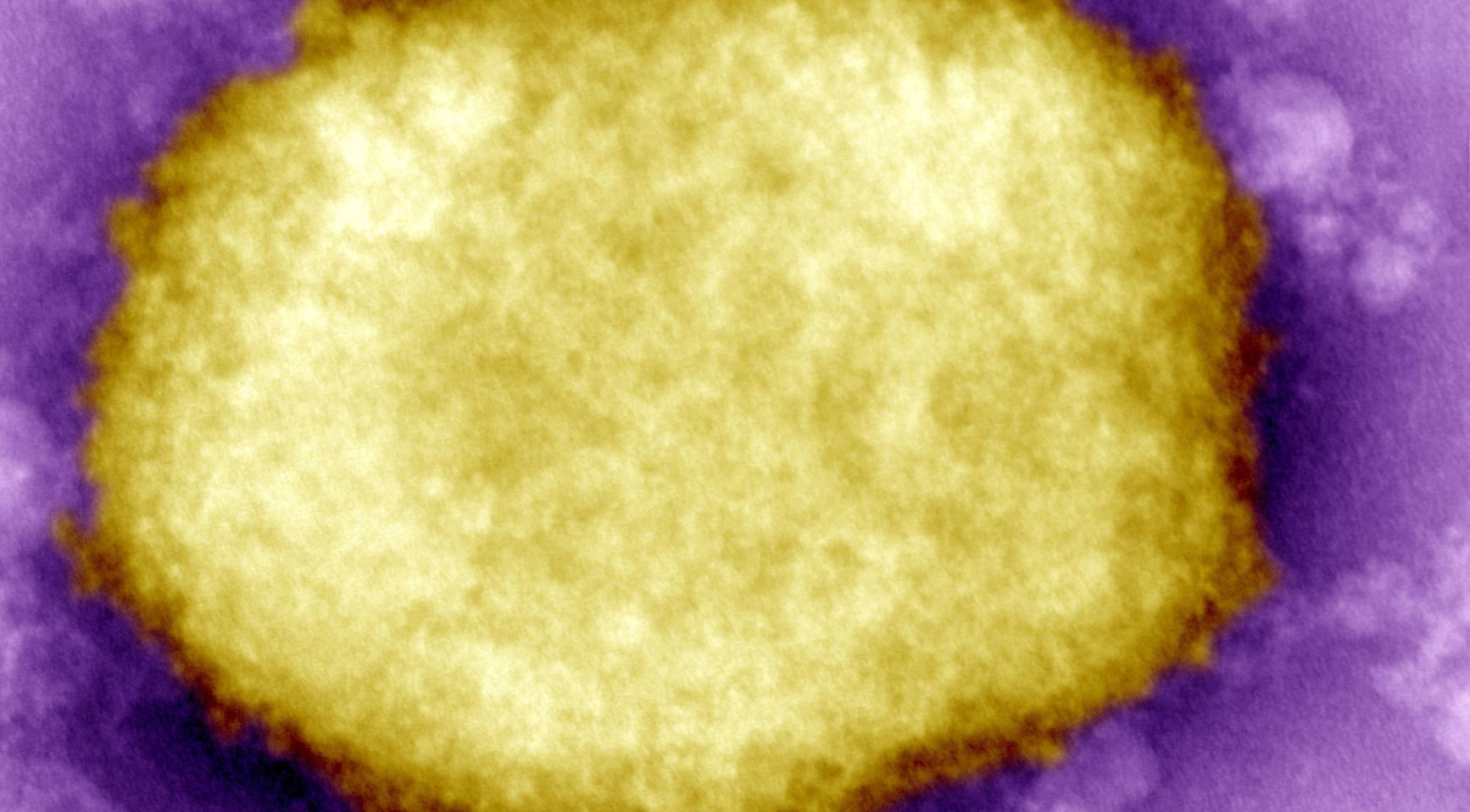 Nederland meldt eerste geval van nieuwe monkeypox-stam