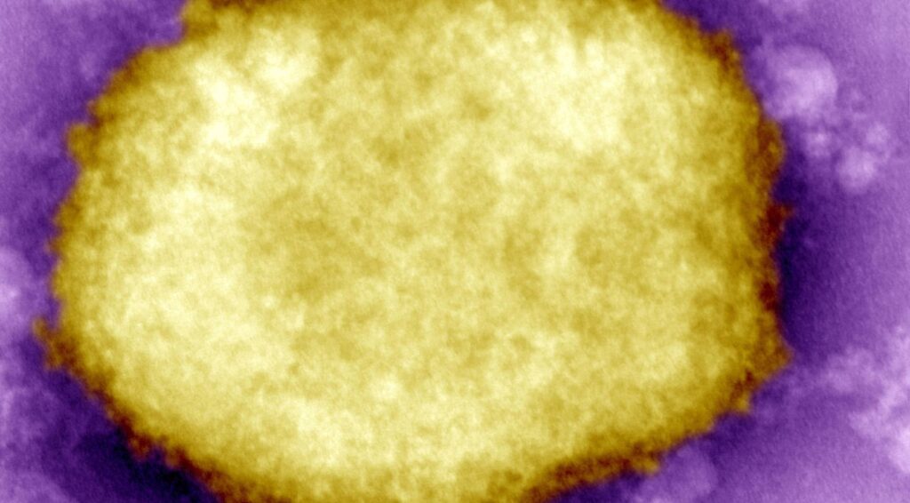 Nederland meldt eerste geval van nieuwe MPOX-strain