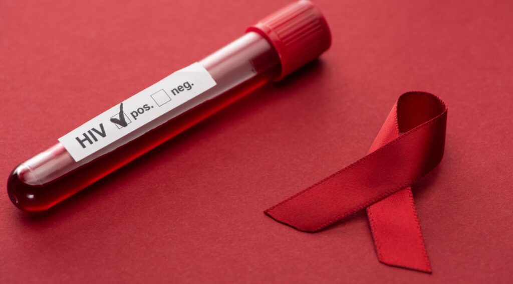 Aantal nieuwe hiv-infecties in Nederland blijft al vijf jaar onveranderd