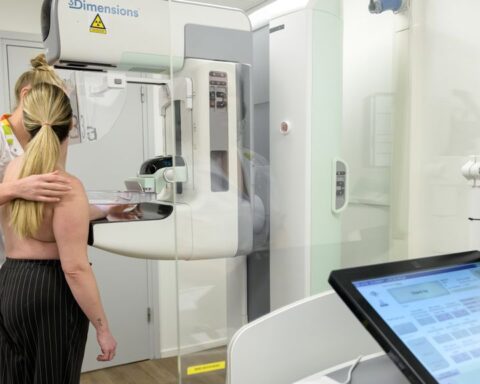 Extra MRI-scan voor vrouwen met dicht borstweefsel begint in 2030