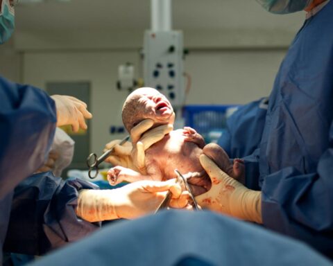 Duizenden Nederlandse vrouwen ervaren jaarlijks pijn tijdens keizersnedes