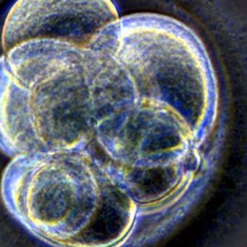 Tweede Kamer accepteert kweek van menselijke embryo's voor onderzoek