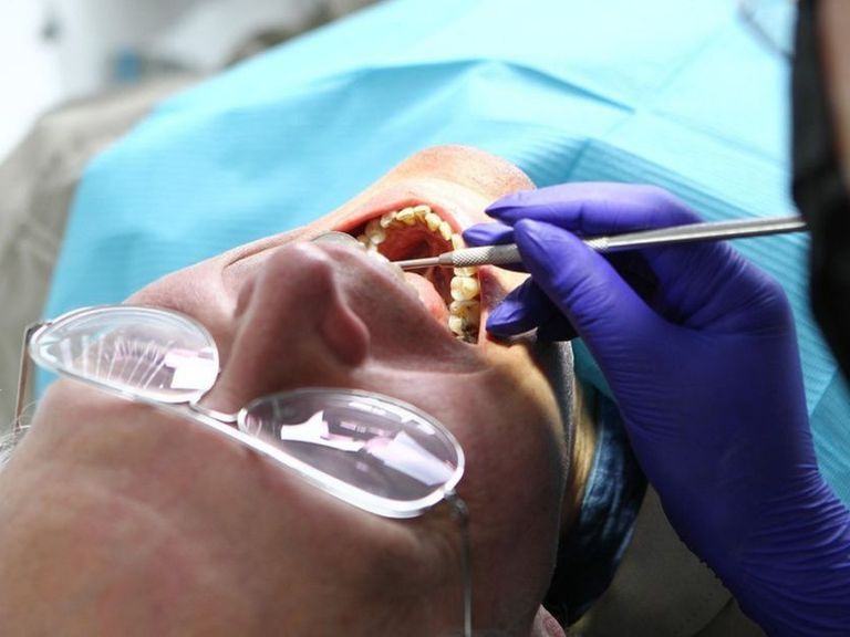 Commerciële tandartspraktijken zetten ouderen onder druk met ongewenste zorgbezoeken