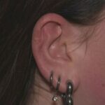 Piercingshop in Coevorden sluit na tientallen meldingen van ontstekingen aan het oor