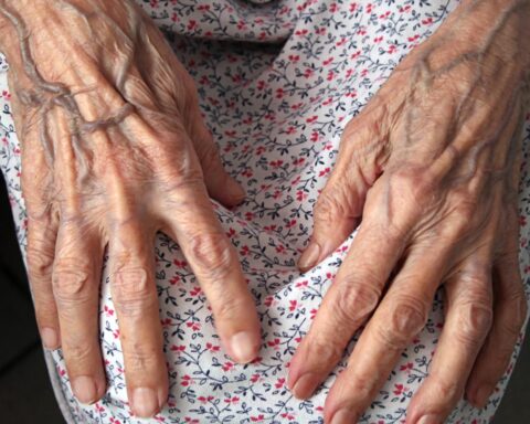 Toegang tot levensreddende openbare defibrillators in arme Nederlandse wijken sterk beperkt