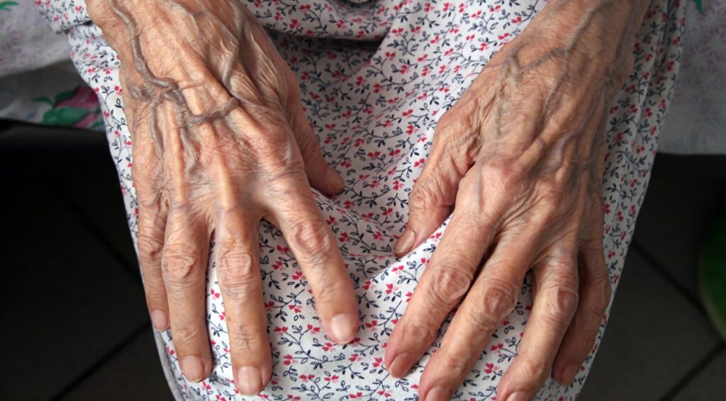 Experts waarschuwen dat de helft van de trauma patiënten nooit volledig herstelt