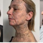 Video: Ex-vriendin heeft zijn naam 250 keer op haar lichaam laten tatoeëren; crowdfunding voor verwijdering