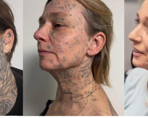 Video: Ex-vriendin heeft zijn naam 250 keer op haar lichaam laten tatoeëren; crowdfunding voor verwijdering