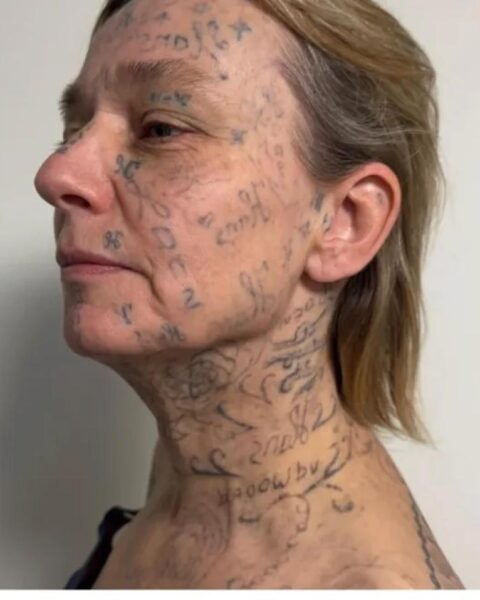 Video: Ex-vriendin heeft zijn naam 250 keer op haar lichaam laten tatoeëren; crowdfunding voor verwijdering