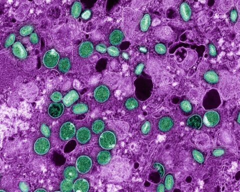 Nederlandse viroloog en collega beschuldigd van smokkelen van inactieve Mpox naar de VS