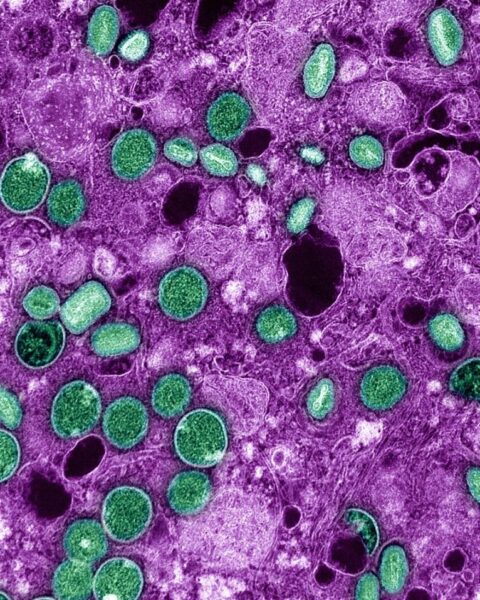 Nederlandse viroloog en collega beschuldigd van smokkelen van inactieve Mpox naar de VS
