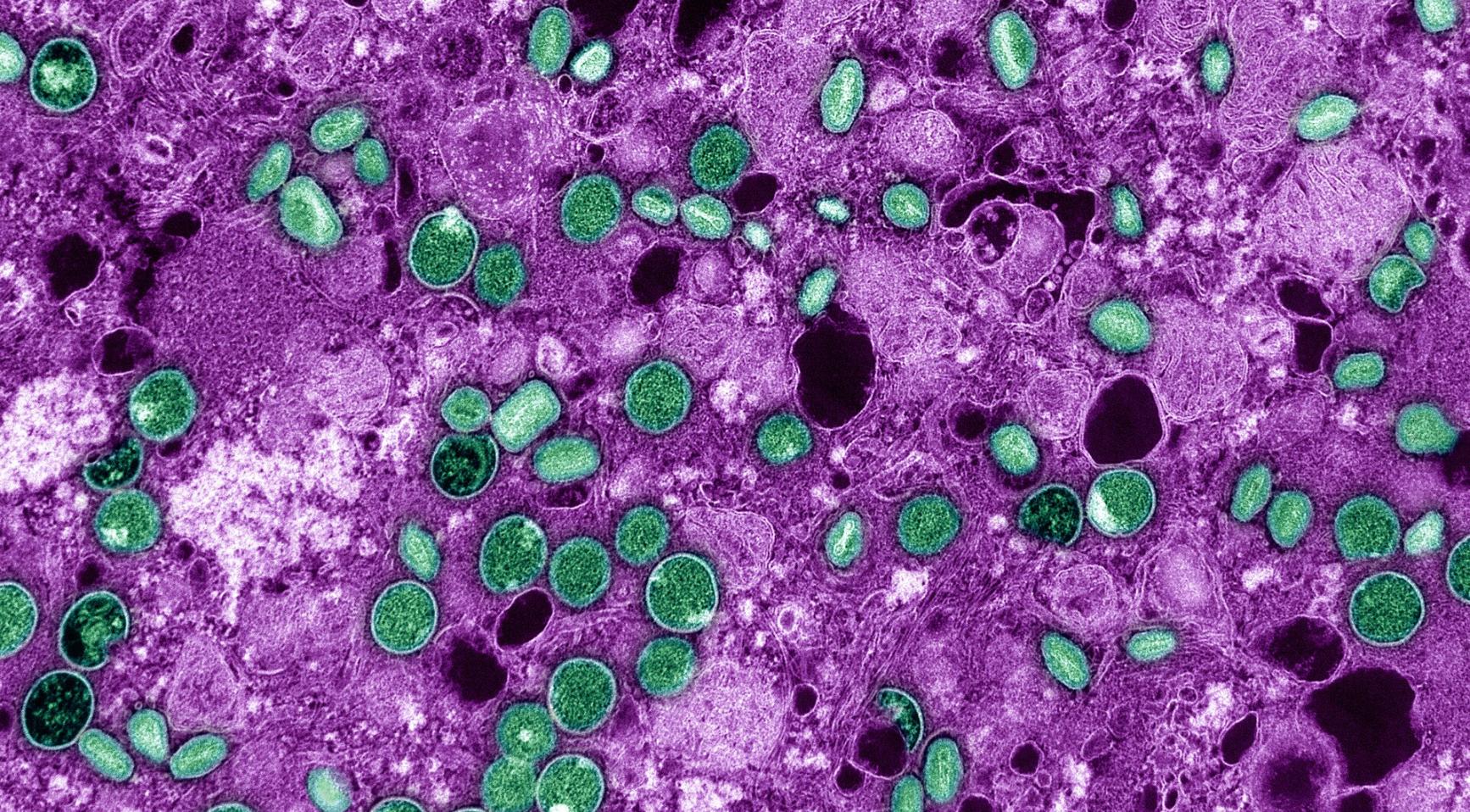 Nederlandse viroloog en collega beschuldigd van smokkelen van inactieve Mpox naar de VS