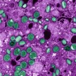 Senior Nederlandse viroloog en collega beschuldigd van smokkelen van Mpox naar de Verenigde Staten