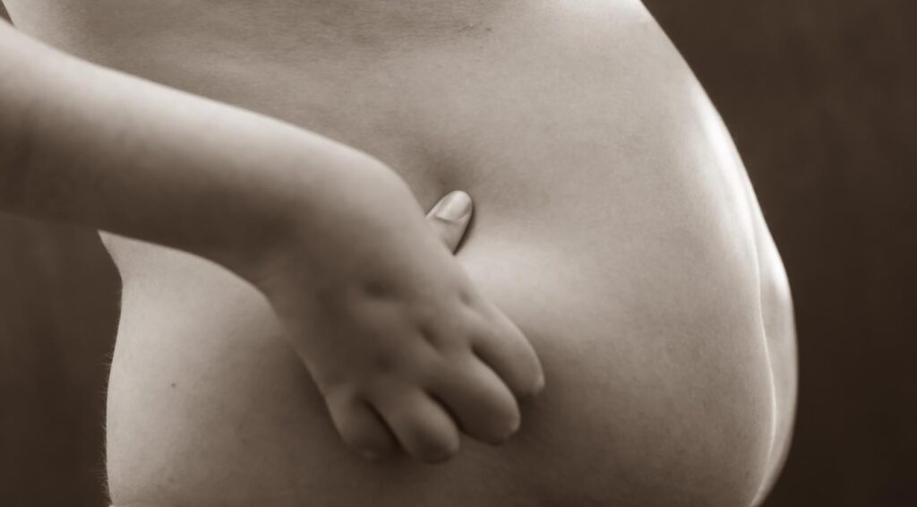 Zorgverzekering in Nederland vergoedt maagverkleinende operatie voor sommige tieners met obesitas