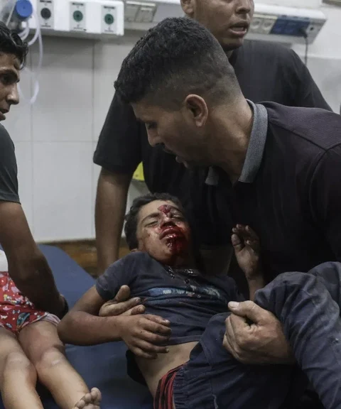 Kabinet zet in op hulptransport van 250 Gazaanse kinderen naar Jordanië met steun van 6 miljoen euro