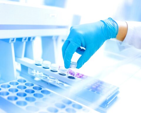 Laboratorium kan screening hervatten een jaar na diefstal van gegevens van 500.000 vrouwen