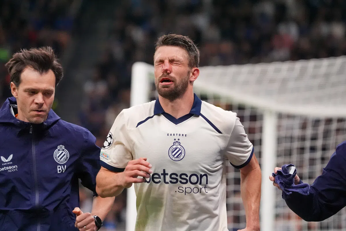 Brandon Mechele van Club Brugge met een bloedneus op het veld tijdens een wedstrijd.