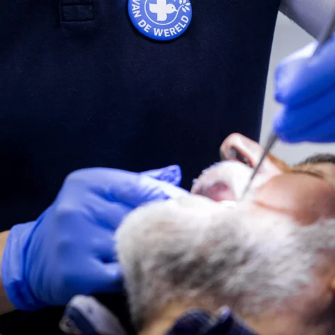 Tandartsbehandeling met handschoenen en mondspiegel bij een patiënt.