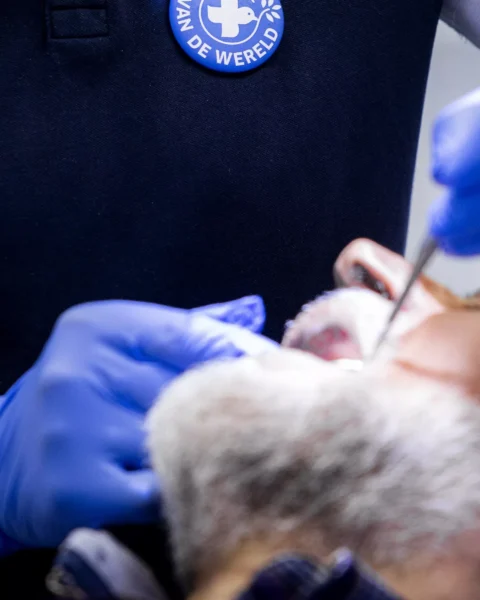 Tandartsbehandeling met handschoenen en mondspiegel bij een patiënt.
